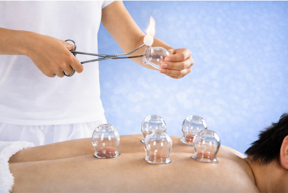 Hacamat (Kupa Terapisi)