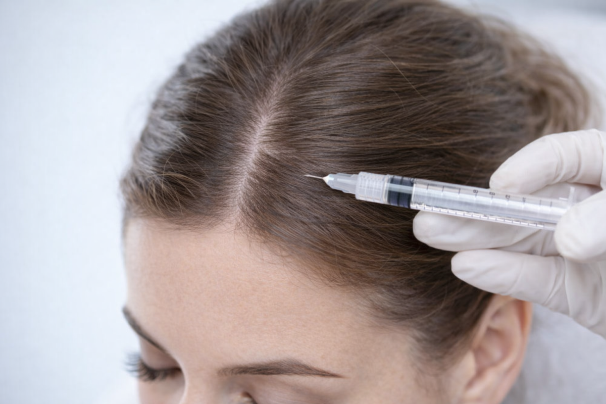 Saç Mezoterapisi